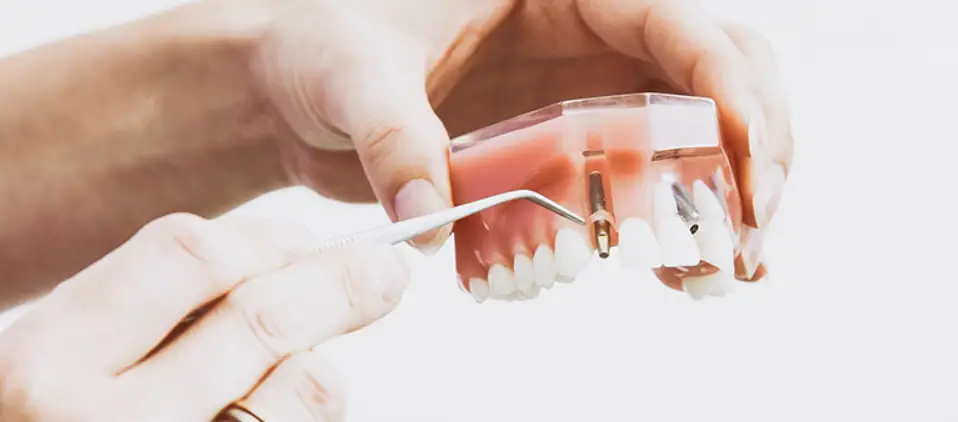 Graphy Tc-80dp Flexible Dentures Instructions Graphy Tc-80dp Flexible Dentures Instructions