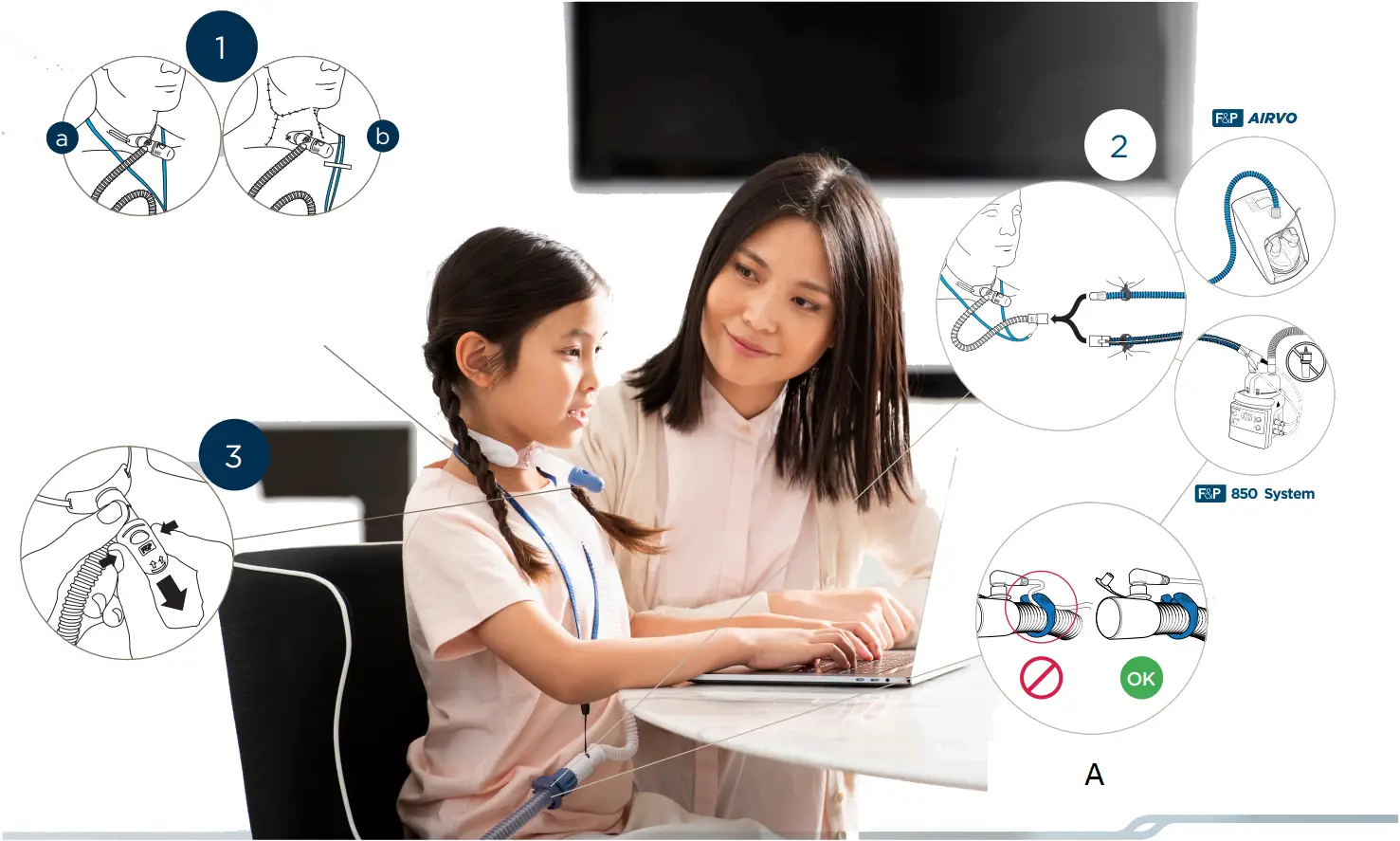 FISHER PAYKEL Optiflow Nasal High Flow Cannula A