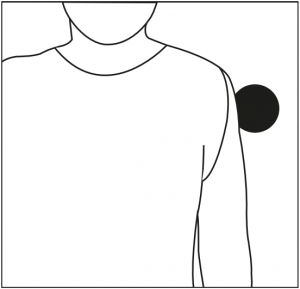 Examples of use - Arm shoulder