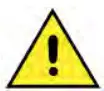 Caution Icon