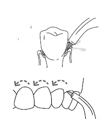 Waterpik WP-560 Water Flosser fig-11