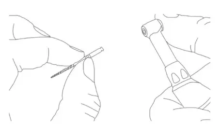 Beyes ApexPilot G1 Endo Motor - Removal of file