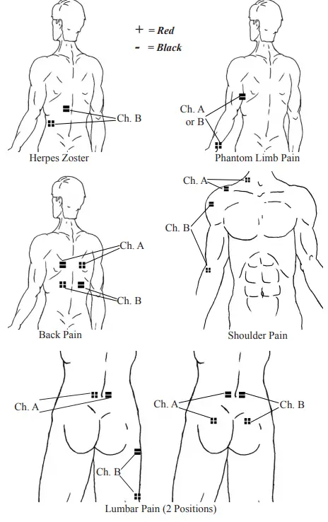 Chattanooga 36038 Primera DUAL CHANNEL TENS & NMES UNIT 4