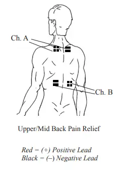 Chattanooga 36038 Primera DUAL CHANNEL TENS & NMES UNIT 5