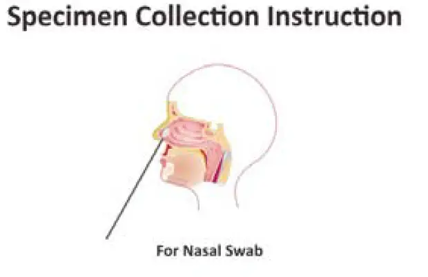 RightSign-ICOVN-C81-COVID-19-Antigen-Rapid-Test-Cassette-FIG- (1)