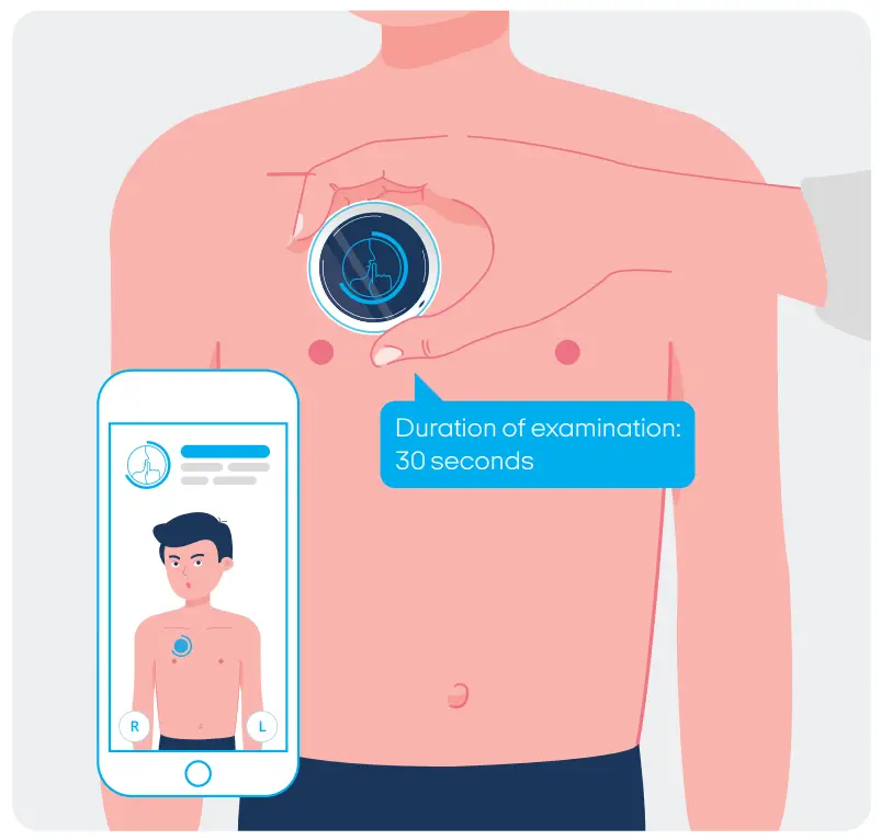 StethoMe-smart-way-of-asthma-monitoring-User-Guide-Fig9