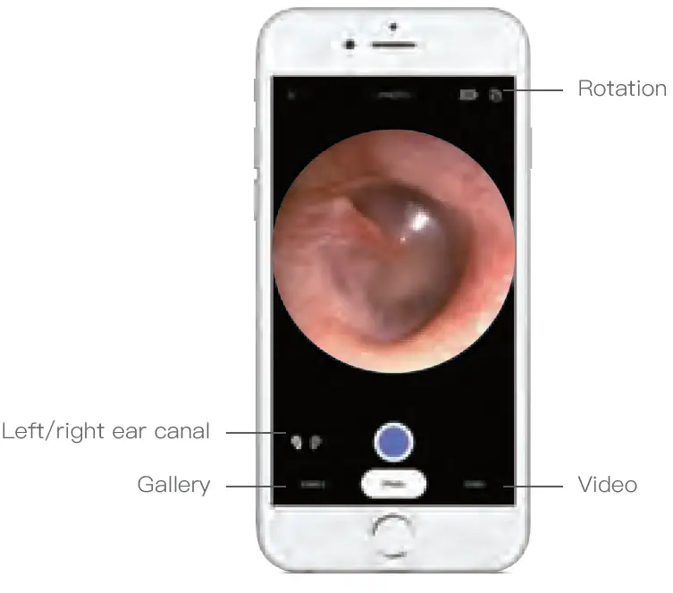 ScopeAround-SA39E-Digital-Otoscope-fig-6