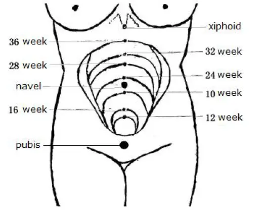 cigii-P612-Ultrasonic-Fetal-Doppler-FIG-5
