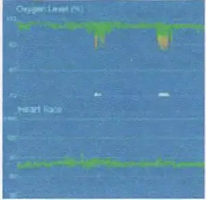 FIG 7 History data and sleep report
