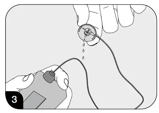 ORBIT-Mylife-Infusion-Sets-FIG- (23)