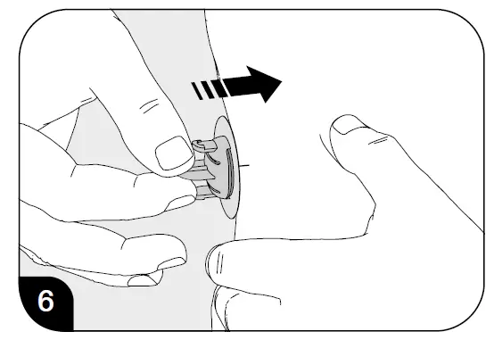 ORBIT-Mylife-Infusion-Sets-FIG- (26)