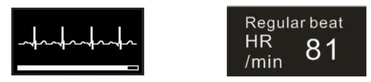 Viatom Blood Pressure Monitor BP2 - measurement result