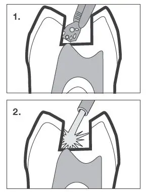 parkell-S370-Amalgam-BondPl-us Self-Curing Bonding Agent 1
