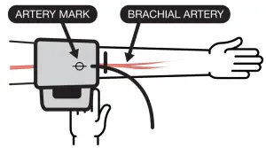 microlife BP B6 Connect Bluetooth Blood Pressure Monitor - figure 3