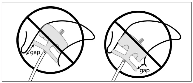 Abbott-Amplatzer-Amulet-Left-Atrial-Appendage-Occluder-6