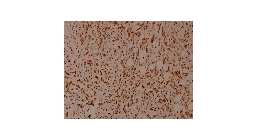 Cecdn Cbp74177 Btla-shp2 Reporter Cell Instructions Cecdn Cbp74177 Btla-shp2 Reporter Cell Instructions