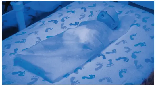 BIONIX Swaddler Eye Protectors for Phototherapy-1