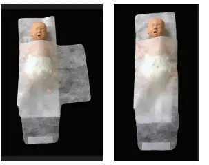 BIONIX Swaddler Eye Protectors for Phototherapy-3