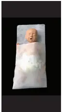 BIONIX Swaddler Eye Protectors for Phototherapy-4