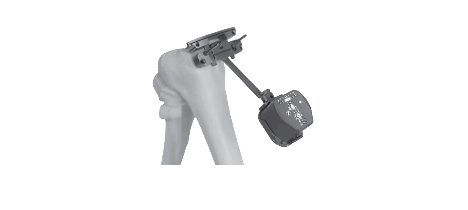 Zimmer Biomet 50001 Computer Assisted Stereotaxic Surgical Instrument System Instruction Manual Zimmer Biomet 50001 Computer Assisted Stereotaxic Surgical Instrument System Instruction Manual