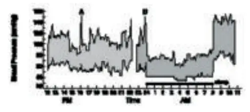 SENCOR SBP 100 Wrist Blood Pressure Monitor - blood pressure