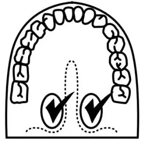 FIG 4 POSITION THERMOMETER