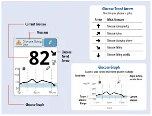 sensor glucose readings
