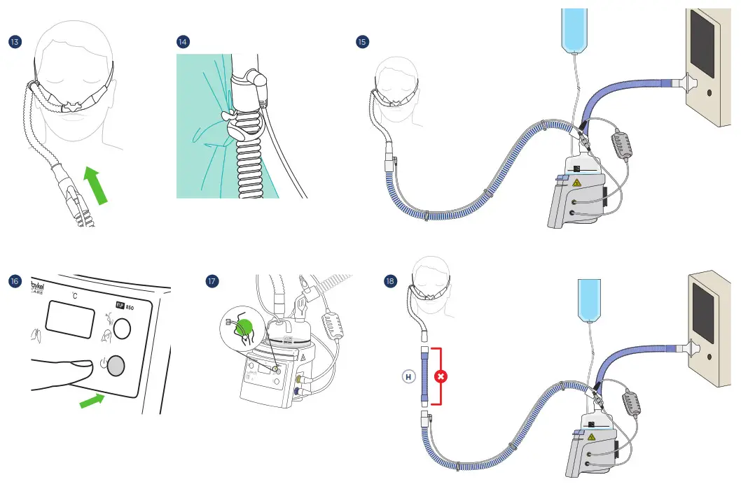 F P 850A61J 850 AirSpiral Adult NIV and NHF Circuit Kit - 4