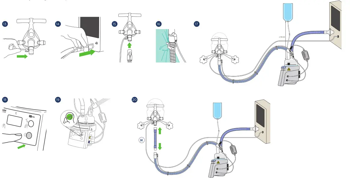 F P 850A61J 850 AirSpiral Adult NIV and NHF Circuit Kit - 6