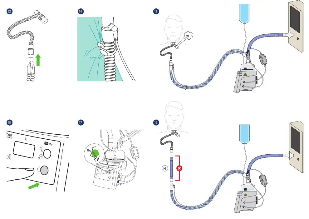 F P 850A61J 850 AirSpiral Adult NIV and NHF Circuit Kit - 7