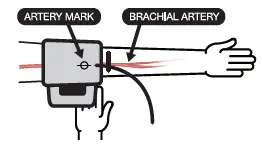 microlife-BPB2-Basic-Blood-Pressure-Monitor-fig-3