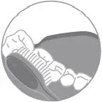 Y2088 - Brushing Method 2