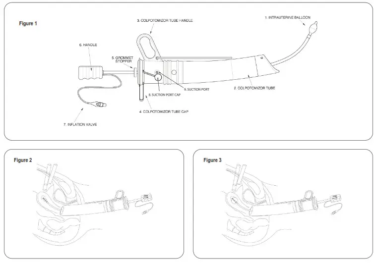 THE O R COMPANY CTS35-TV ColpotomizOR Tube System - 1