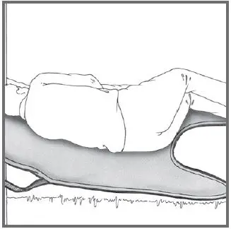 HUMAN-CARE-25045-Basic-Patient-Lifting-Sling-fig- (22)