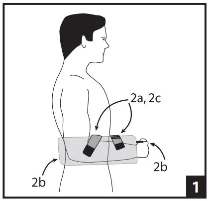 DJO 1-1344-4-06000 UltraSling IV ER 15 Degree Left Large User Guide - Unfasten the Velcro straps at the forearm and wrist positions on the outside of the sling