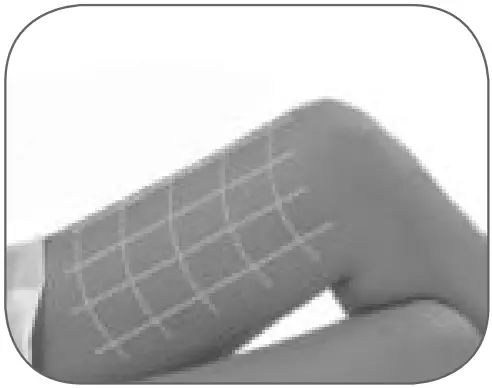 BaByliss G960E Smart Hair Remover IPL - FIg 24