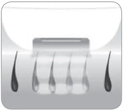 BaByliss G960E Smart Hair Remover IPL - FIg 5