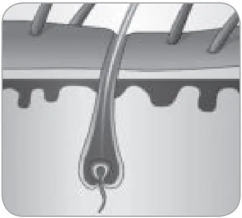 BaByliss G960E Smart Hair Remover IPL - FIg 7