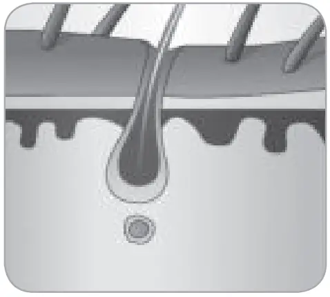 BaByliss G960E Smart Hair Remover IPL - FIg 8