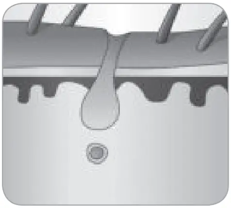 BaByliss G960E Smart Hair Remover IPL - FIg 9