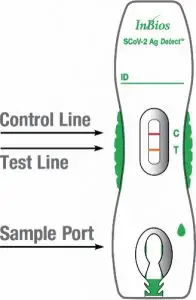 FIG 1 PRINCIPLE OF THE TEST