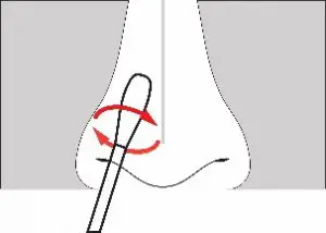 FIG 5 Sample Collection and Handling