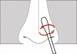 FIG 6 Sample Collection and Handling