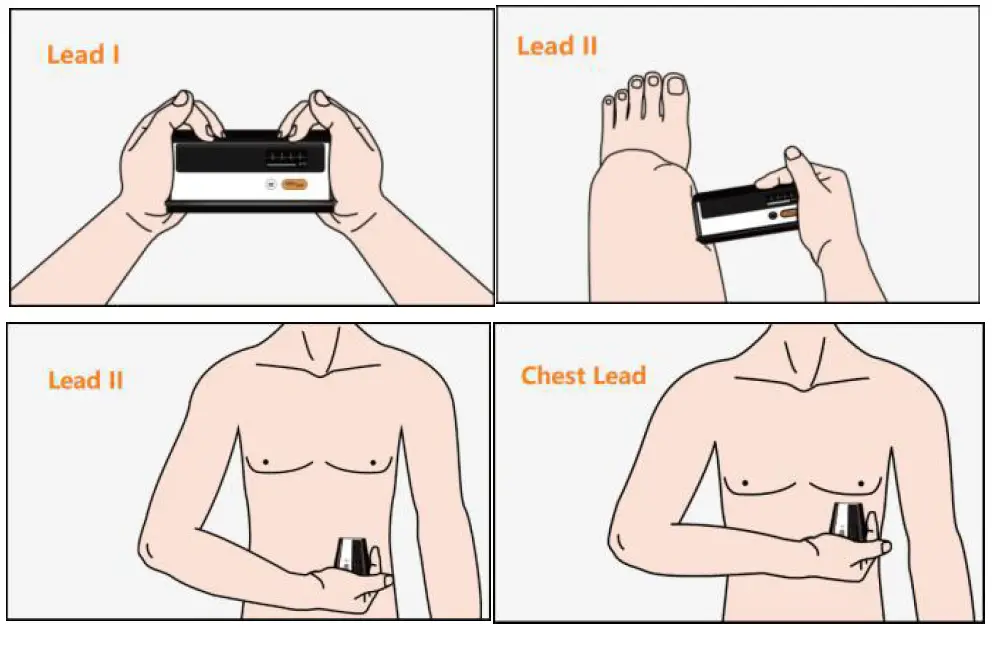 viatom BP2A Blood Pressure Monitor 6