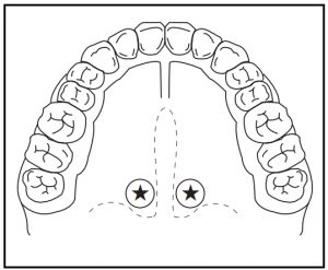 Tooth Diagram