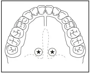 Tooth Diagram