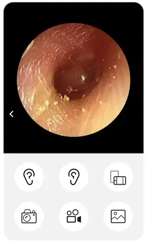 Shenzhen Outchat Technology EONE Smart Ear Cleaner - Download the app before use 3