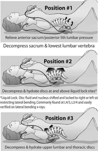 POSTURE 2000 Elliptical Back Rocker Disc Hydrator - fig 5