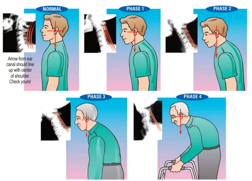 POSTURE 2000 Elliptical Back Rocker Disc Hydrator