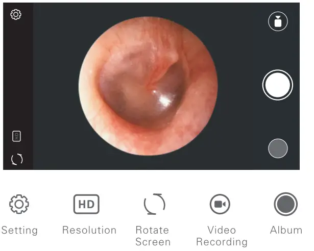 AKNTE100i-Ear-Wax-Removal-Tool-fig-7